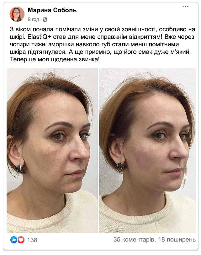Image title