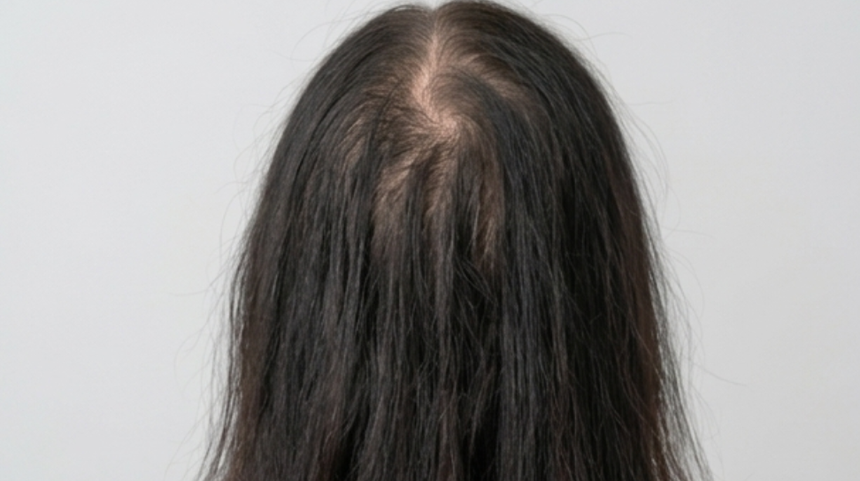 Crecimiento lento del cabello